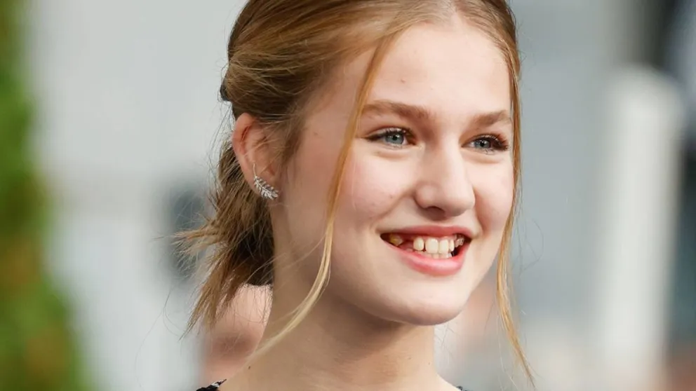 La razón hereditaria de la dentadura imperfecta de la Princesa Leonor