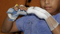 Niños heridos por pirotecnia en Salta durante los festejos de año nuevo