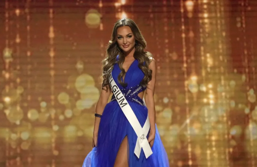 Chayenne Van Aerle, modelo de Miss Universo, se recupera tras el terrible accidente: así quedó su rostro