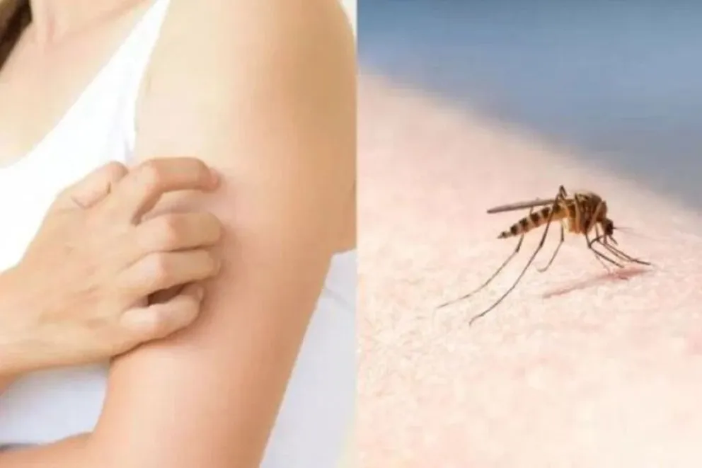 La Capital salteña contaría con casos de dengue autóctonos: "Tenemos una situación crítica controlada”