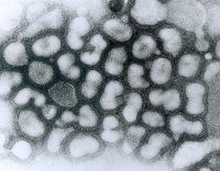 Gripe aviar en Salta: cómo se contagia, cuáles son sus síntomas y cómo prevenirla 