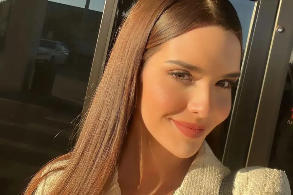 Amanda Dudamel sin filtros, mostró las cirugías que se hizo antes de participar de Miss Universo