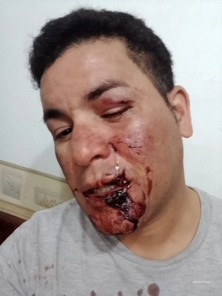Foto: Denuncia al circo