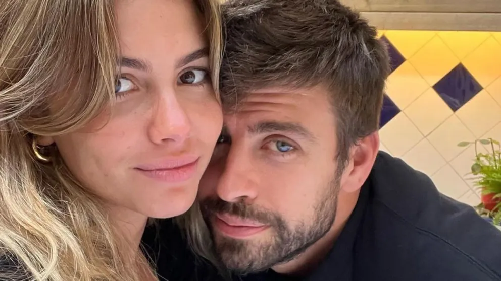 Quiere parecerse a Shakira: Clara Chía sorprende con retoque estético en su rostro