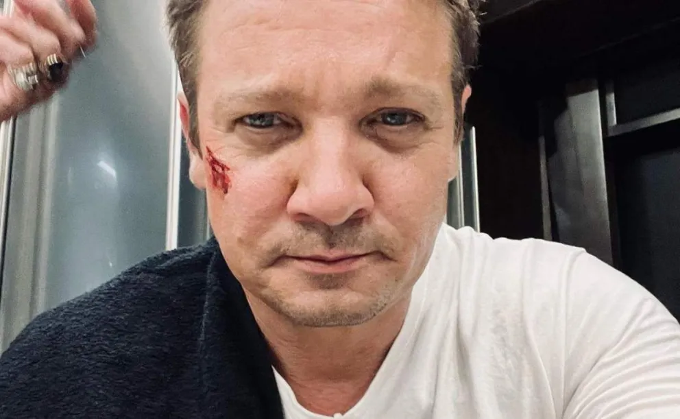 Jeremy Renner aparece por primera vez luego de su trágico accidente: lo que sintió en el momento
