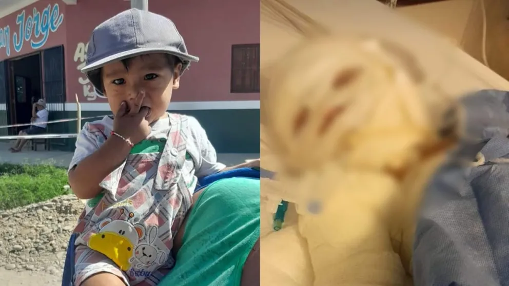 Luego de la desesperante espera, finalmente se trasladó a Salta al niño con graves quemaduras