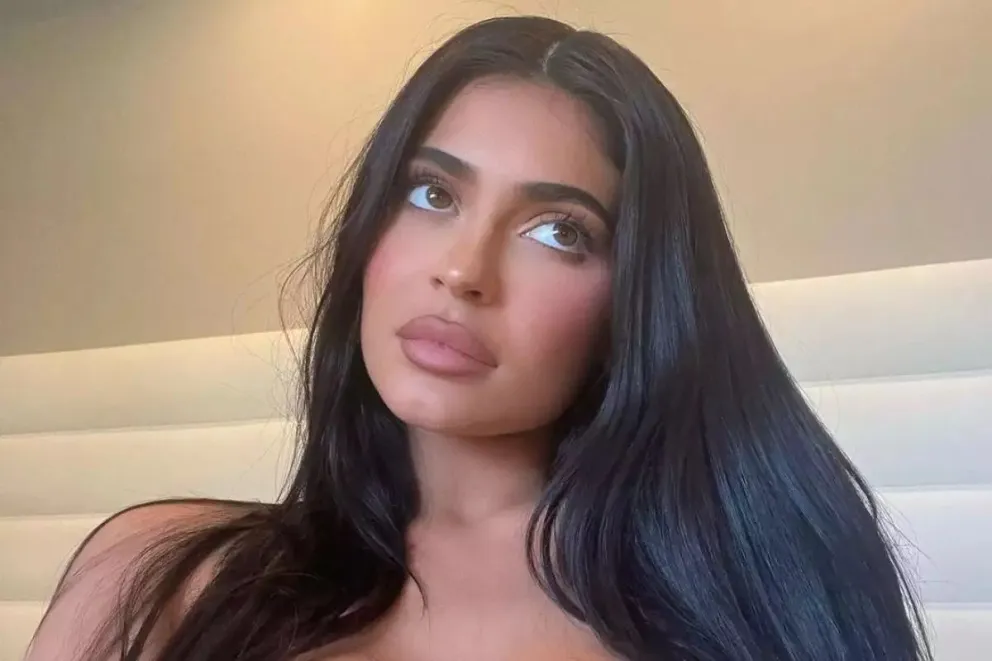 La asombrosa revelación de Kylie Jenner sobre las cirugías de su rostro: sorprendió a todos