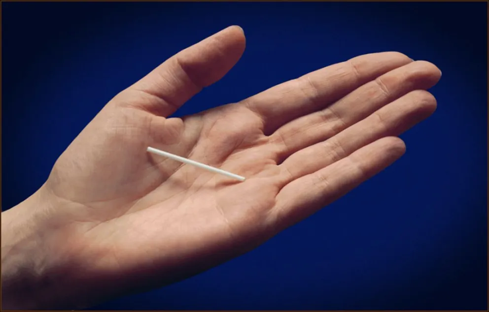 Gran demanda por la colocación de implantes subdérmicos: enterate cuando será la próxima convocatoria