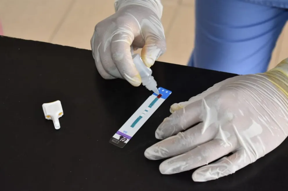 Realizarán test de VIH gratuitos: entérate cuándo y dónde asistir     