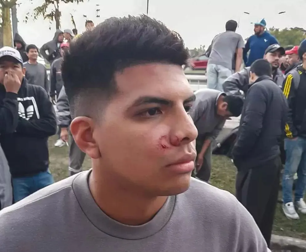 Manifestación en Coca Cola: Cuatro personas heridas por bala de goma y 5 detenidos