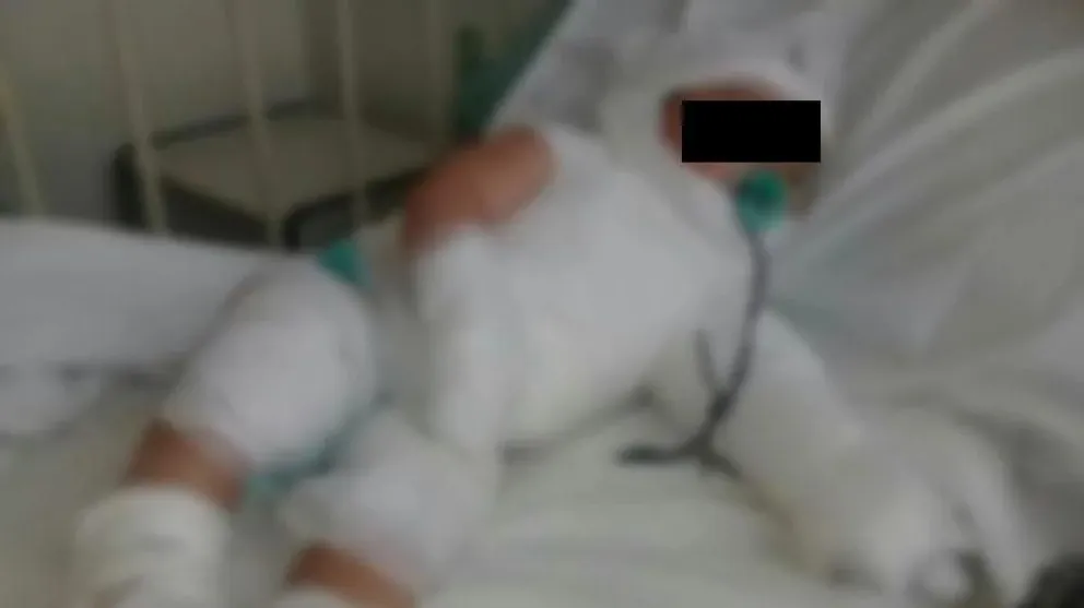 Tres niños internados con quemaduras por incendio de vivienda en Pichanal