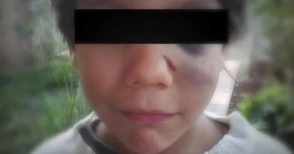 Un niño denunció entre lagrimas que su papá le pegó varias veces en la cara con un cable 