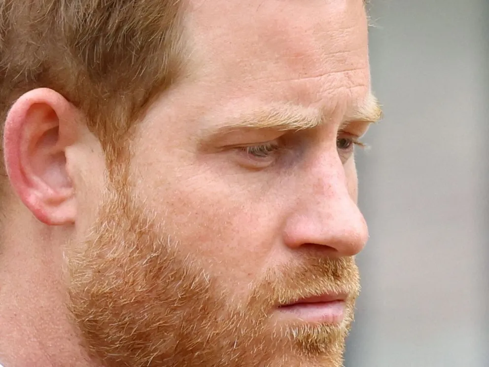 El príncipe Harry padece de una extraña enfermedad que lo avergüenza y le genera depresión